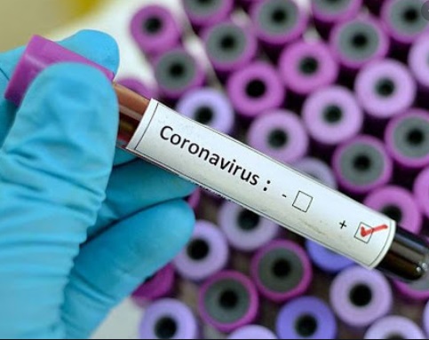 Colombia llegó a 11.613 casos de coronavirus y cada día sigue aumentando