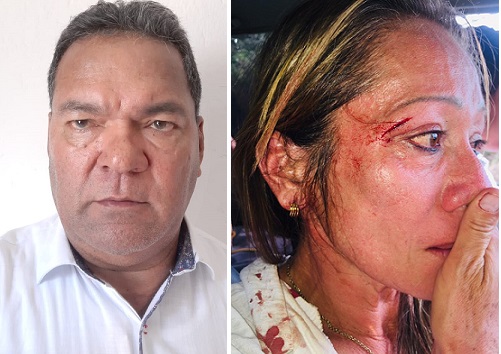 Capturado locutor que agredió en plena vía a su mujer en Pueblo Bello – Cesar