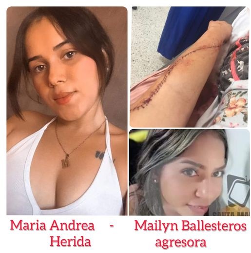 Herida mujer con un bisturí en un ataque de celos en San Diego (Cesar): más de 127 puntos de sutura